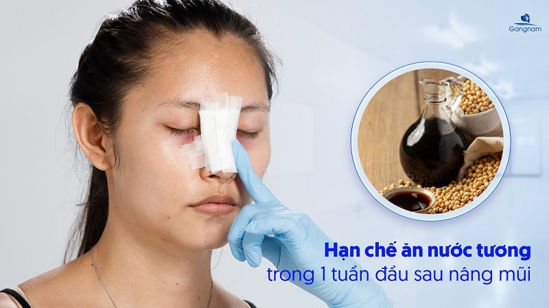 Nâng mũi ăn nước tương được không? 6 Nâng mũi ăn nước tương được không?