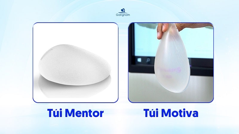 Nâng ngực giọt nước - Phương pháp thẩm mỹ vòng 1 an toàn, tự nhiên 7 Nâng ngực giọt nước