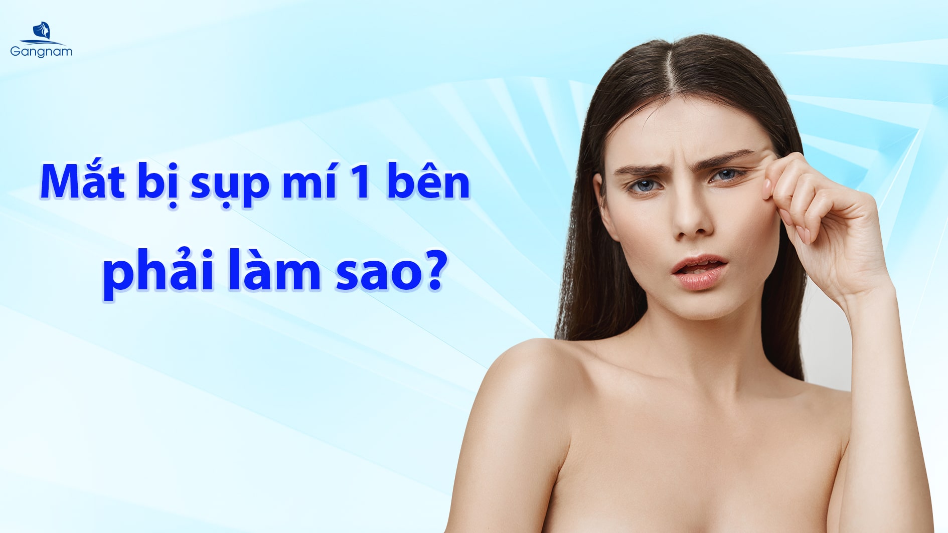 Mắt bị sụp mí 1 bên phải làm sao? 4 Mắt bị sụp mí 1 bên phải làm sao?