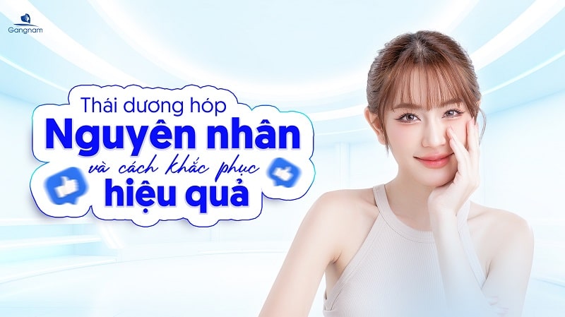 Thái dương hóp - Nguyên nhân và cách khắc phục hiệu quả 5 Thái dương hóp