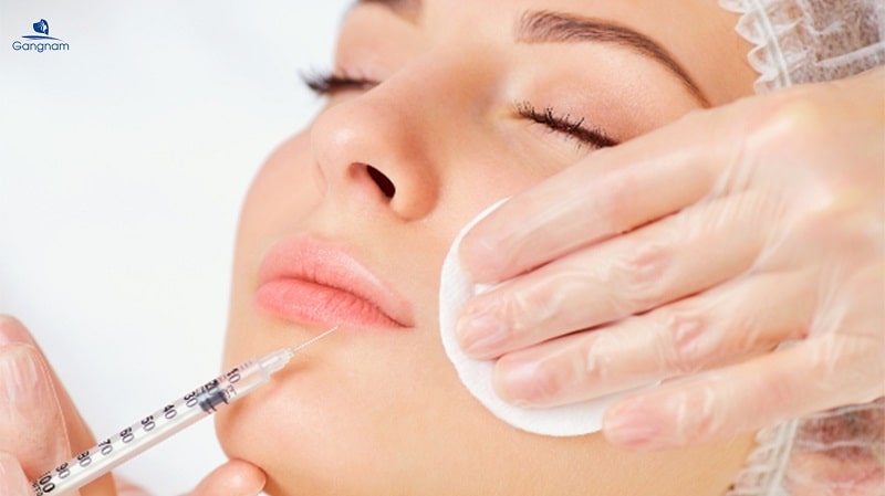 Tiêm Filler bị vón cục có nguy hiểm không? 7 Tiêm Filler bị vón cục