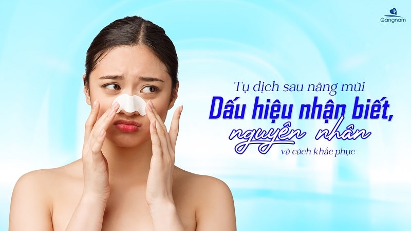 Tụ dịch sau nâng mũi - Dấu hiệu nhận biết, nguyên nhân và cách khắc phục 5 Tụ dịch sau nâng mũi