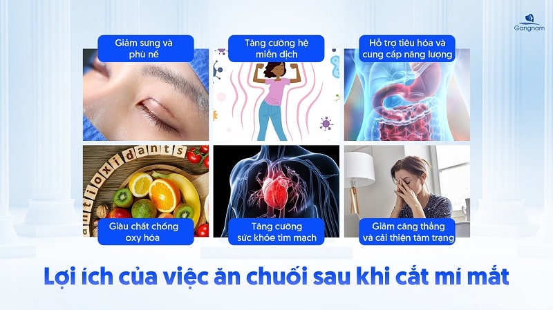 Cắt mí có được ăn chuối không? 6 Cắt mí có được ăn chuối không?