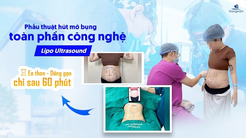 Có nên đeo đai nịt bụng khi ngủ không? 6 Có nên đeo đai nịt bụng khi ngủ không?