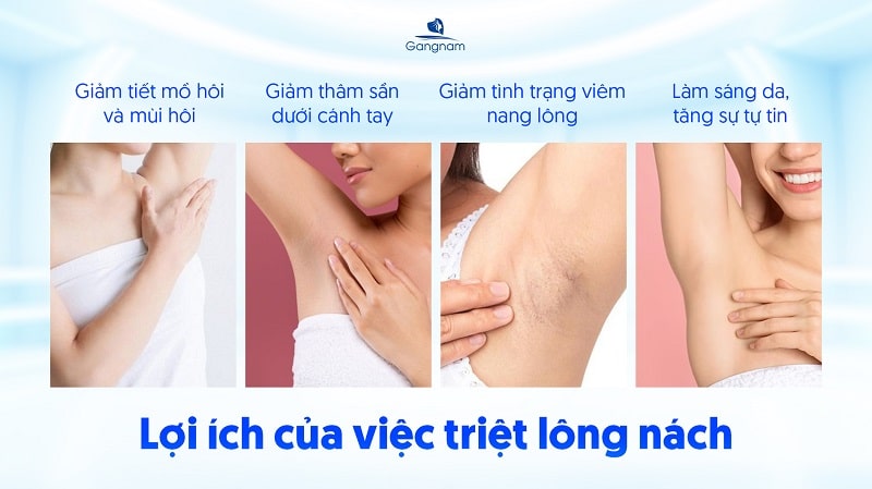 Có nên triệt lông nách không? 5 Có nên triệt lông nách không?