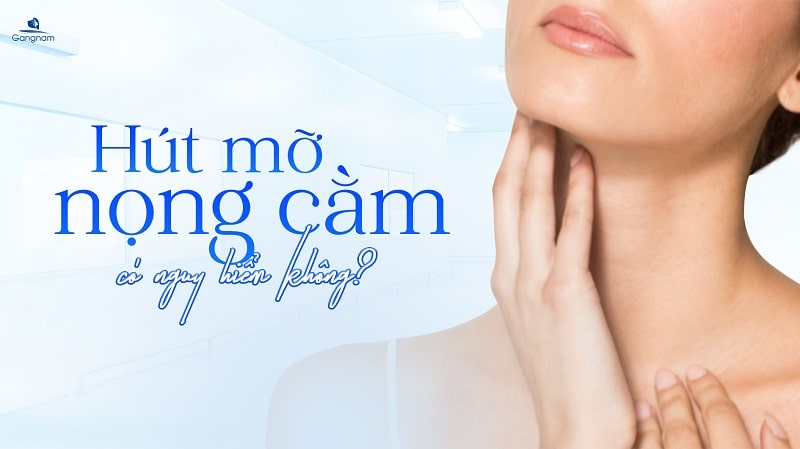 Hút mỡ nọng cằm có nguy hiểm không? 5 Hút mỡ nọng cằm có nguy hiểm không?