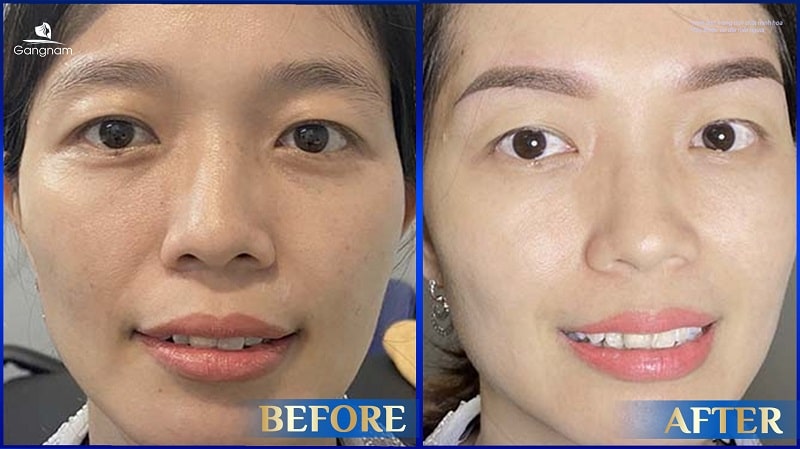 Lông mày trăng non là gì? Ý nghĩa tướng số như thế nào? 8 Lông mày trăng non là gì?