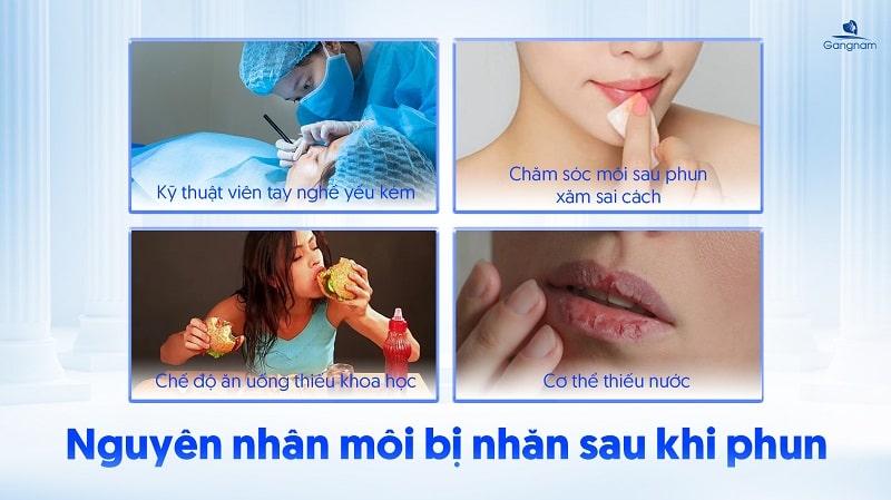 Môi bị nhăn sau khi phun - Nguyên nhân và cách khắc phục hiệu quả 6 Môi bị nhăn sau khi phun
