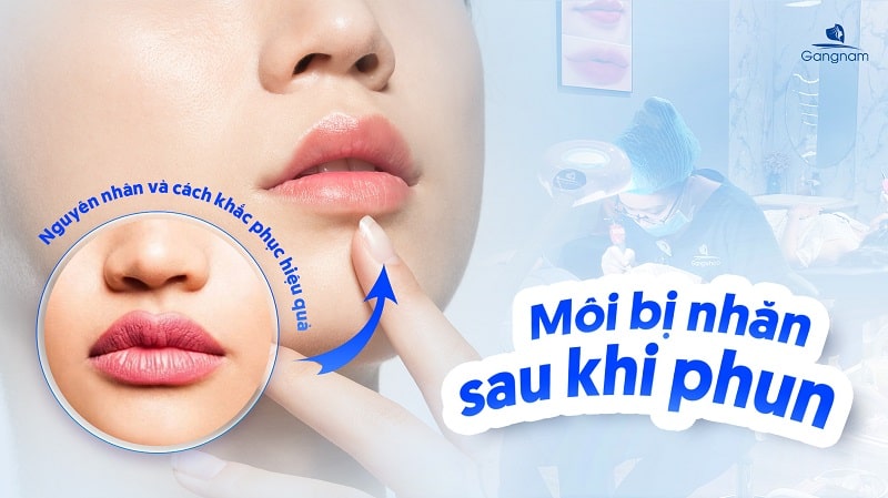Môi bị nhăn sau khi phun - Nguyên nhân và cách khắc phục hiệu quả 5 Môi bị nhăn sau khi phun