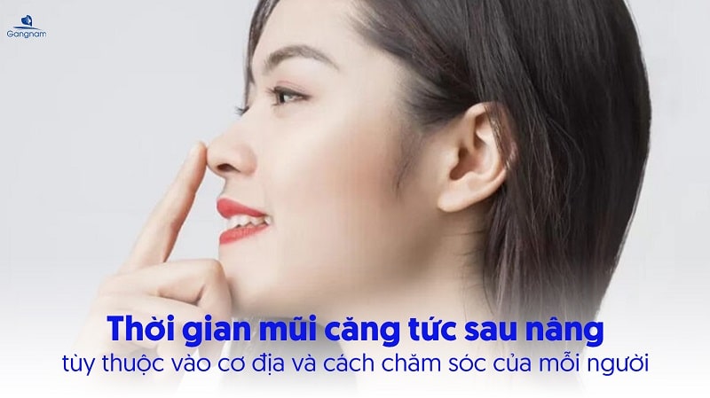 Nâng mũi bao lâu thì hết căng tức? 5 Nâng mũi bao lâu thì hết căng tức?