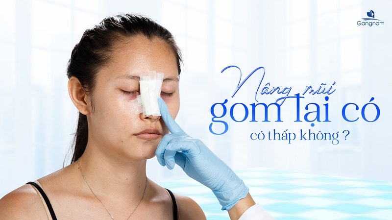 Nâng mui gom lại có thấp không? 4 Nâng mui gom lại có thấp không?