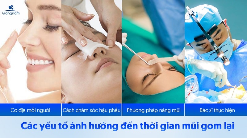 Nâng mui gom lại có thấp không? 5 Nâng mui gom lại có thấp không?