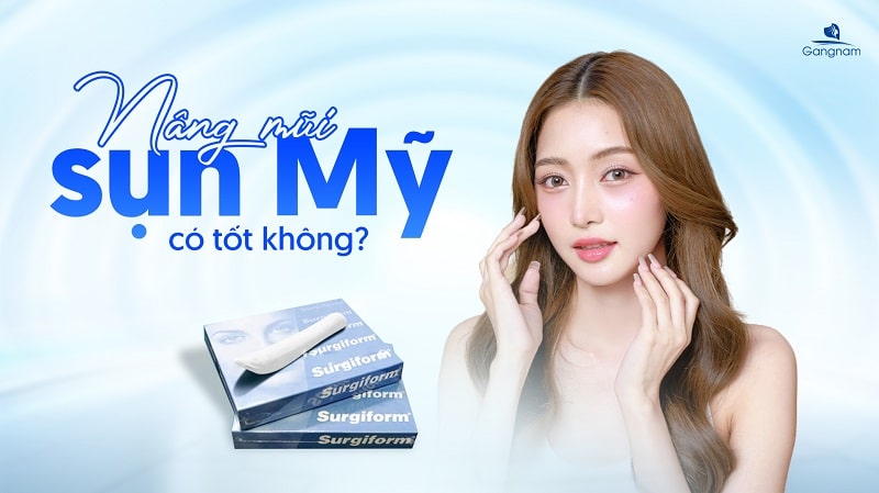 Nâng mũi sụn Mỹ có tốt không? 5 Nâng mũi sụn Mỹ