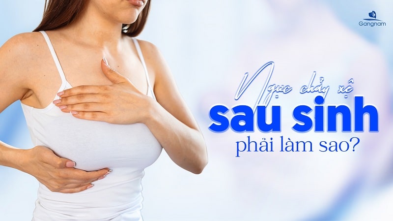 Ngực chảy xệ sau sinh phải làm sao? 5 Ngực chảy xệ sau sinh phải làm sao?