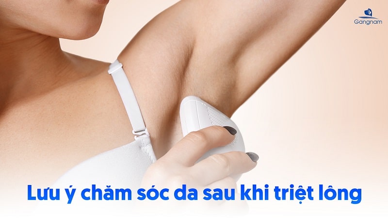 Triệt lông nên kiêng gì để tránh gây tổn thương da? 6 Triệt lông nên kiêng gì?