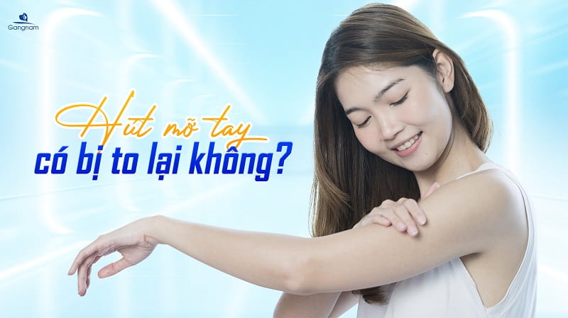 Hút mỡ bắp tay có bị to lại không? 4 Hút mỡ bắp tay có bị to lại không?