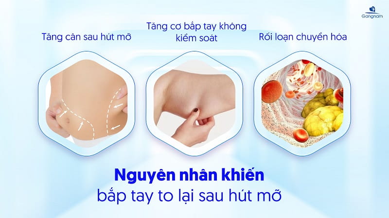 Hút mỡ bắp tay có bị to lại không? 5 Hút mỡ bắp tay có bị to lại không?