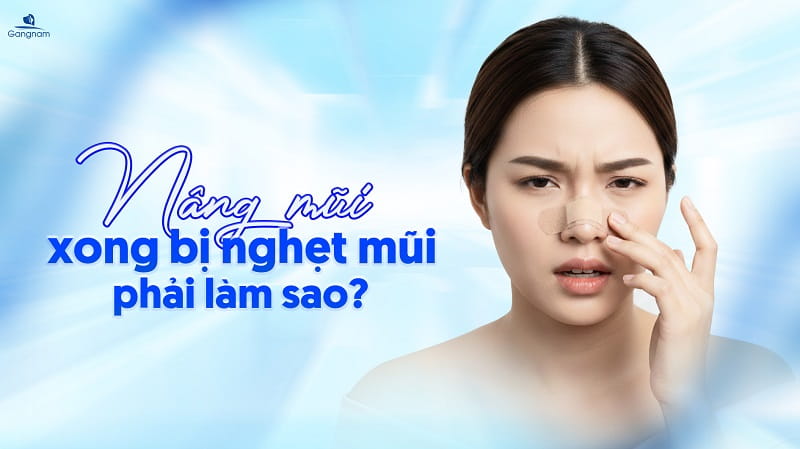 Nâng mũi xong bị nghẹt mũi phải làm sao? 4 Nâng mũi xong bị nghẹt mũi