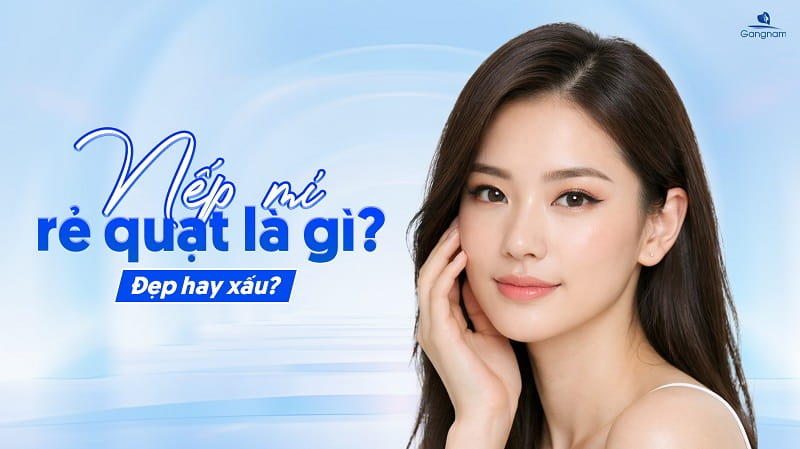 Nếp mí rẻ quạt là gì? Đẹp hay xấu? 4 Nếp mí rẻ quạt là gì?