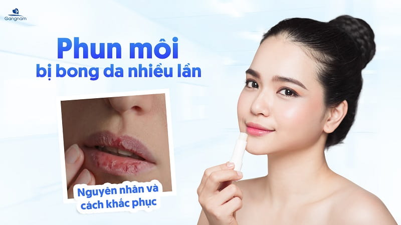 Phun môi bị bong da nhiều lần có sao không? 5 Phun môi bị bong da nhiều lần
