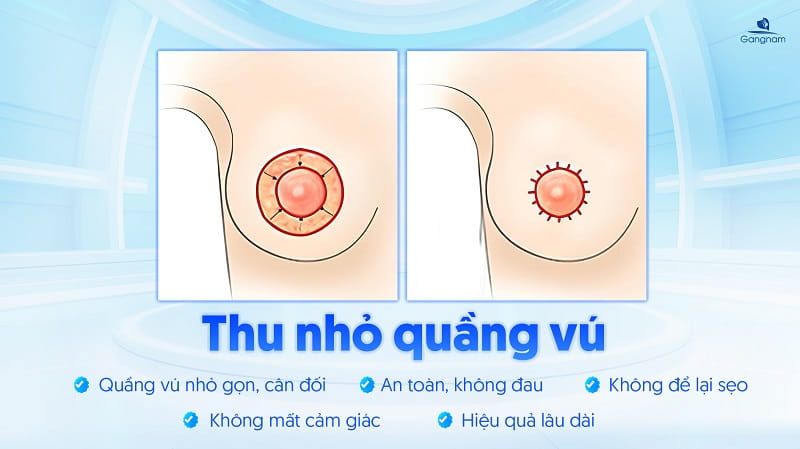 Thu nhỏ quầng vú - Tái tạo "nụ hồng" chỉ sau 60 phút 5 Thu nhỏ quầng vú