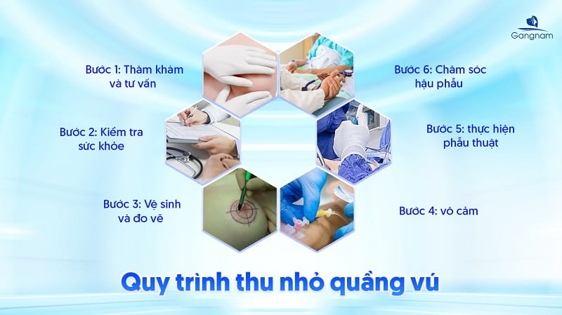 Thu nhỏ quầng vú - Tái tạo "nụ hồng" chỉ sau 60 phút 6 Thu nhỏ quầng vú