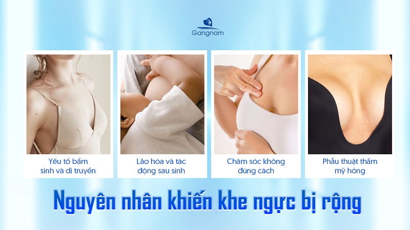 Khe ngực rộng - Nguyên nhân và cách khắc phục hiệu quả 6 Khe ngực rộng
