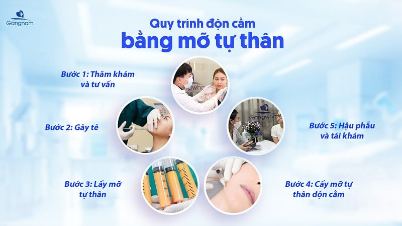 Độn cằm bằng mỡ tự thân là gì? Duy trì được bao lâu? 5 Độn cằm bằng mỡ tự thân
