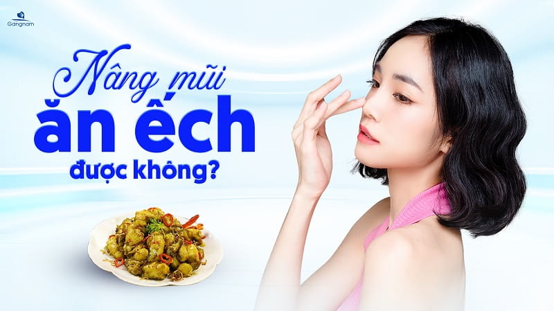 Nâng mũi ăn ếch được không? 4 Nâng mũi ăn ếch được không?