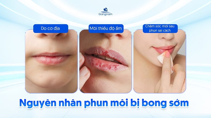 Phun môi 2 ngày đã bong có sao không? 6 Phun môi 2 ngày đã bong