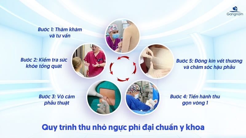 Thu nhỏ ngực phì đại - Giải pháp cho vòng 1 thon gọn chuẩn form 7 Thu nhỏ ngực phì đại