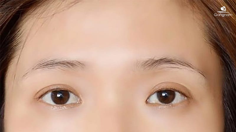 Lông mày bị rụng có mọc lại không? 6 Lông mày bị rụng có mọc lại không?