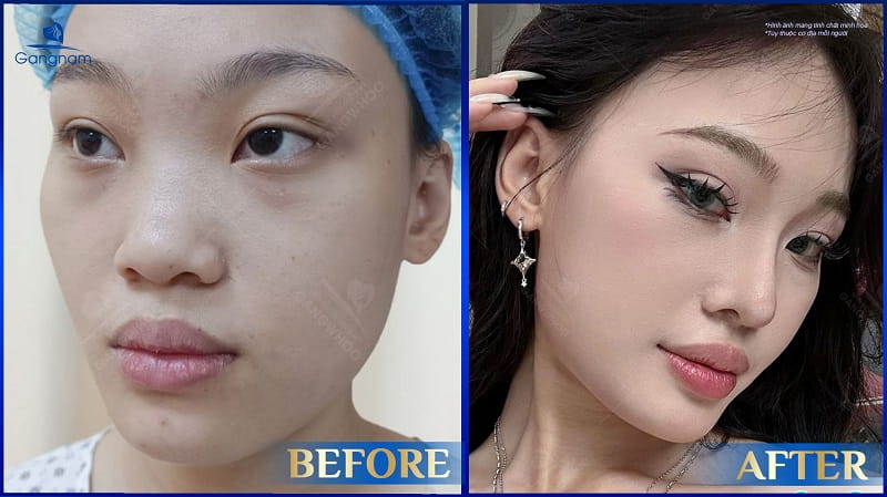 Mũi khoằm là gì? Tướng mũi khoằm tốt hay xấu? 6 Mũi khoằm là gì?