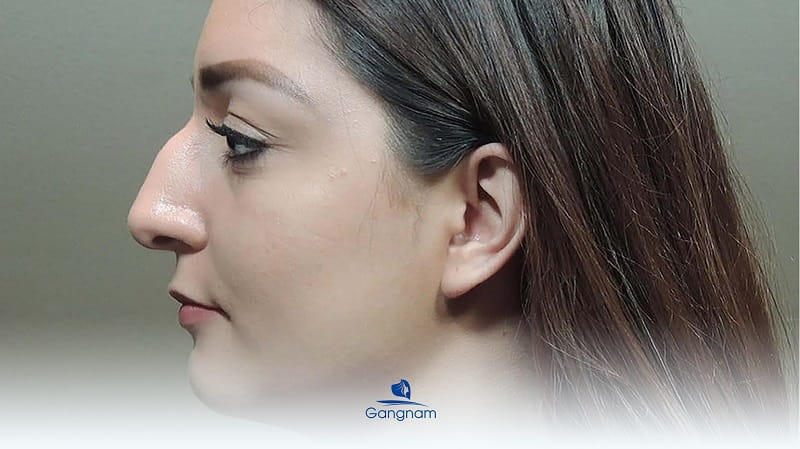 Mũi khoằm là gì? Tướng mũi khoằm tốt hay xấu? 5 Mũi khoằm là gì?