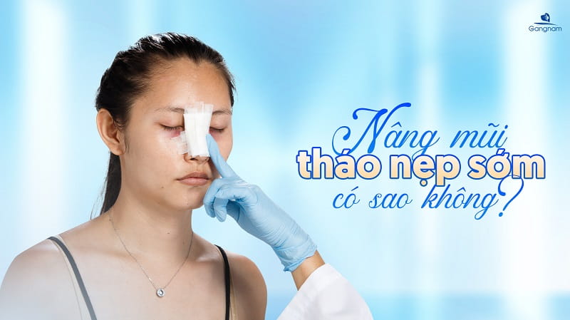 Nâng mũi tháo nẹp sớm có sao không? 4 Nâng mũi tháo nẹp sớm có sao không?