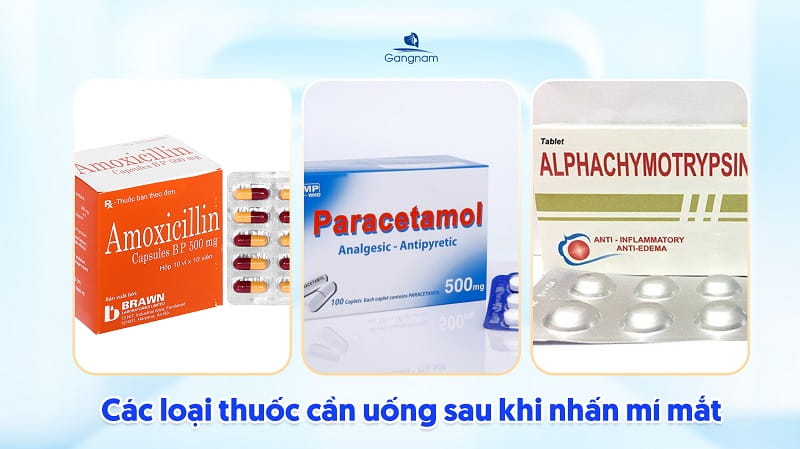 Nhấn mí uống thuốc gì? 6 Nhấn mí uống thuốc gì?