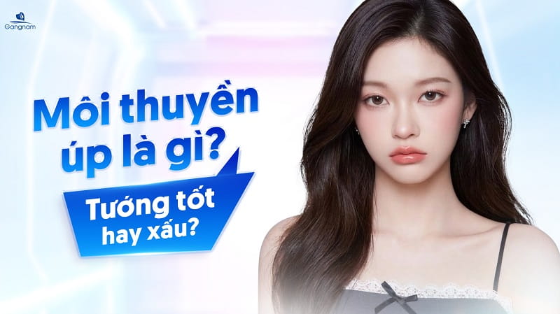 Môi thuyền úp là gì? Tướng tốt hay xấu? 4 Môi thuyền úp là gì?