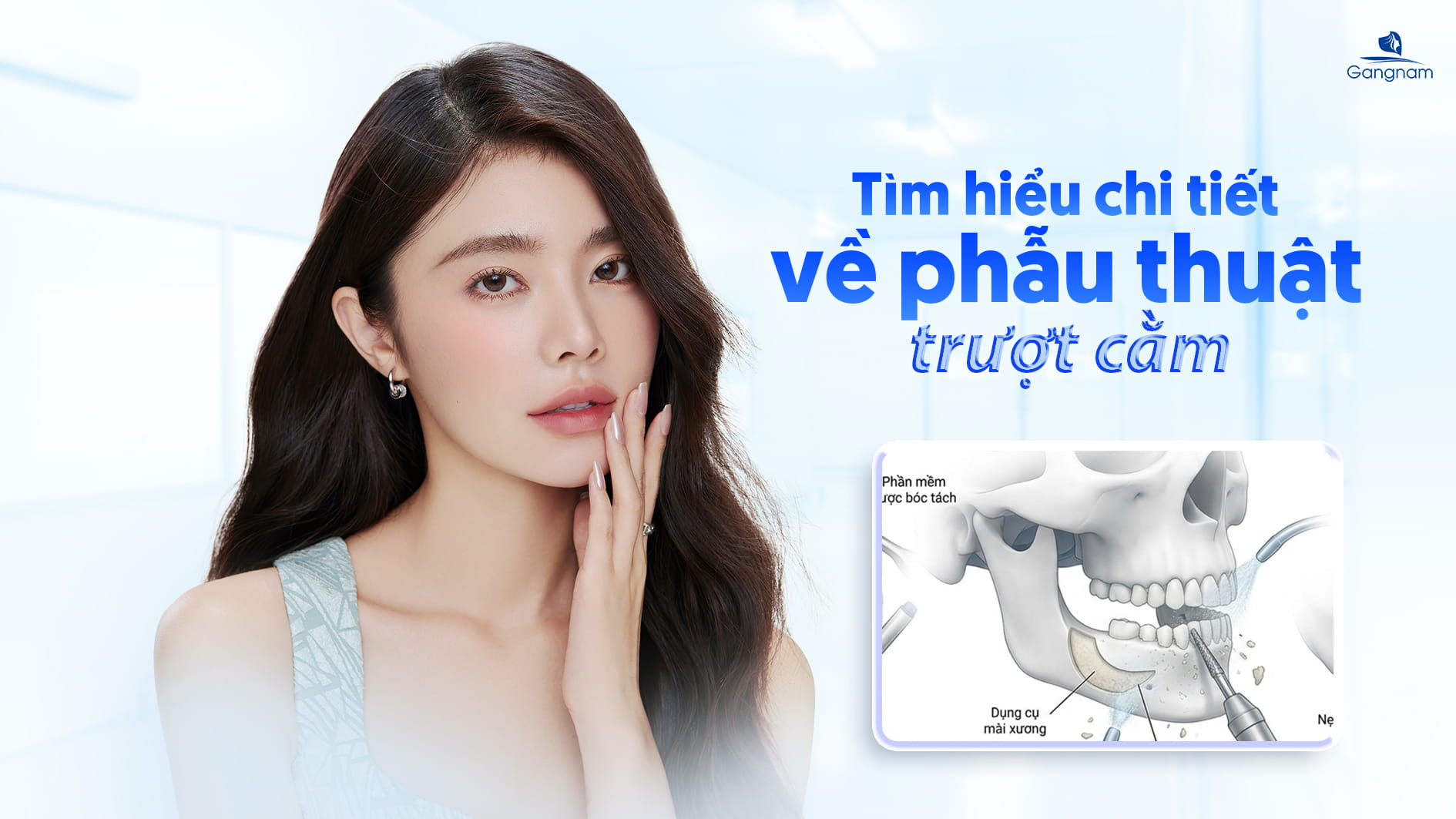 Phẫu thuật trượt cằm: Ưu điểm, đối tượng và những lưu ý quan trọng 5 Phẫu thuật trượt cằm