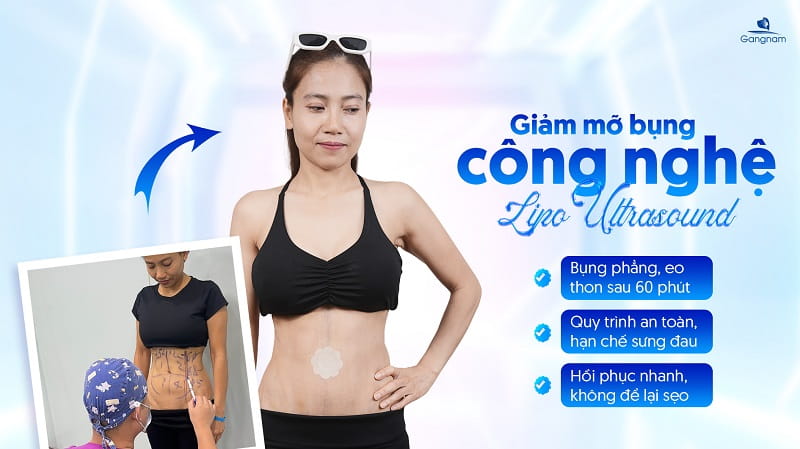 Hướng dẫn cách đeo đai nịt bụng sau hút mỡ 6 Cách đeo đai nịt bụng sau hút mỡ