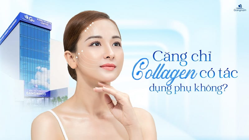 Căng chỉ Collagen có tác dụng phụ không? 4 Căng chỉ Collagen có tác dụng phụ không?