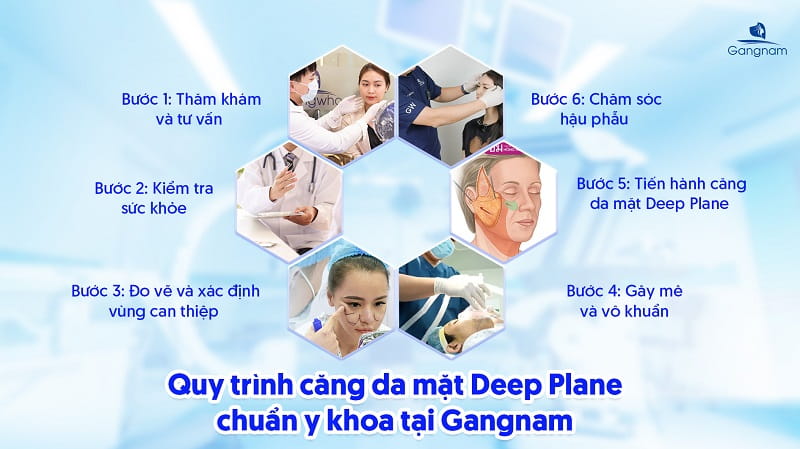 Căng da mặt Deep Plane - Giải pháp trẻ hóa chuyên sâu 7 Căng da mặt Deep Plane