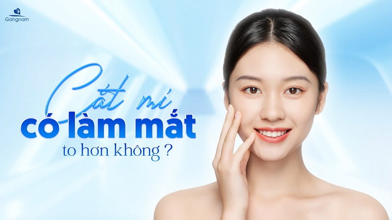 Cắt mí có làm mắt to hơn không? 4 Cắt mí có làm mắt to hơn không?