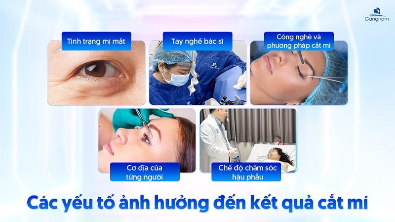 Cắt mí có làm mắt to hơn không? 5 Cắt mí có làm mắt to hơn không?