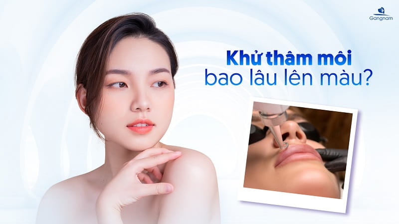 Khử thâm môi bao lâu lên màu? 4 Khử thâm môi bao lâu lên màu?