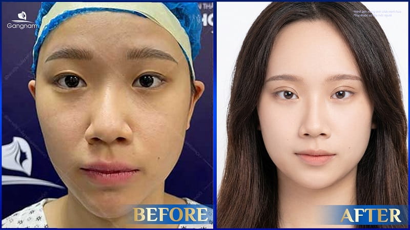 Lông mày gần mắt là gì? Tướng lông mày gần mắt tốt hay xấu? 8 Lông mày gần mắt