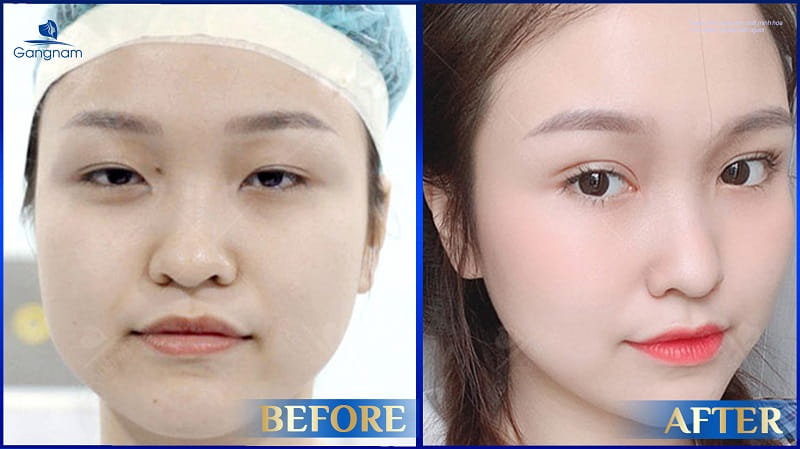 Mắt xa nhau là gì? Tướng số của người có khoảng cách 2 mắt xa nhau 6 Mắt xa nhau là gì?