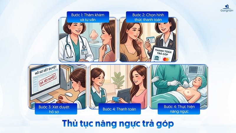 Nâng ngực trả góp - Giải pháp giảm áp lực tài chính cho phái đẹp 7 Nâng ngực trả góp