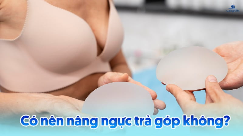 Nâng ngực trả góp - Giải pháp giảm áp lực tài chính cho phái đẹp 6 Nâng ngực trả góp