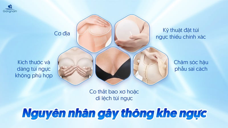 Thông khe ngực là gì? Nguyên nhân và cách khắc phục hiệu quả 6 Thông khe ngực là gì?