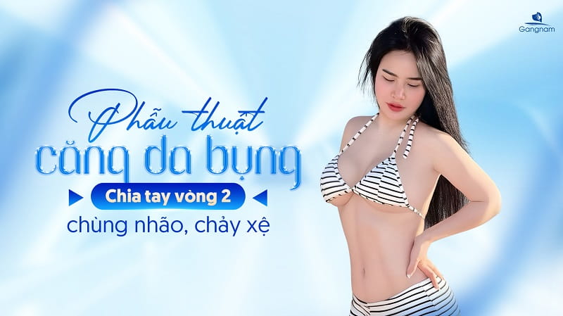 Phẫu thuật căng da bụng là gì? Đối tượng chỉ định và chống chỉ định căng da bụng 5 Căng da bụng
